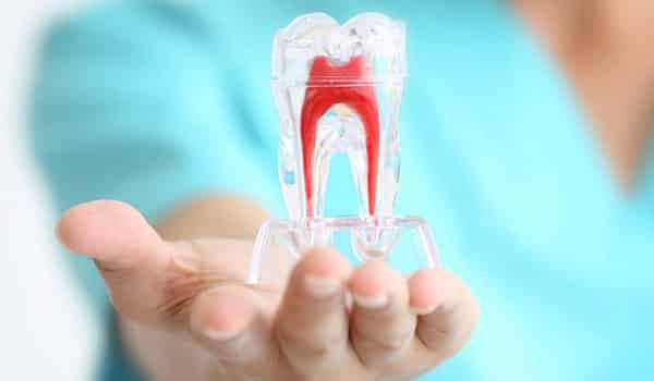Root canal treatment in Mayur Vihar by A&M dental station
