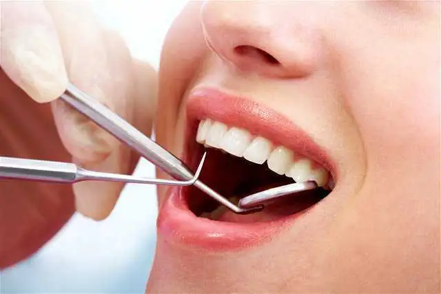 Dental fillings without sensitivity by Dr. Avneesh kr. Sharma